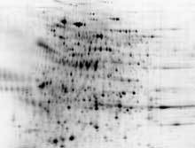 2D-HPE-BlotGel-s.jpg
