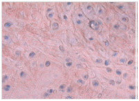 Collagen_CS.jpg