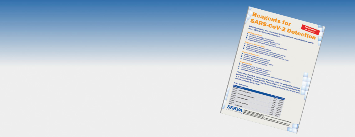 SLIDER_JD_SARS_EN_V1.jpg
